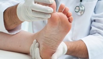 diabetic - neuropathy