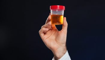 Close up of male's hand holding container with urine sample isolated over dark background